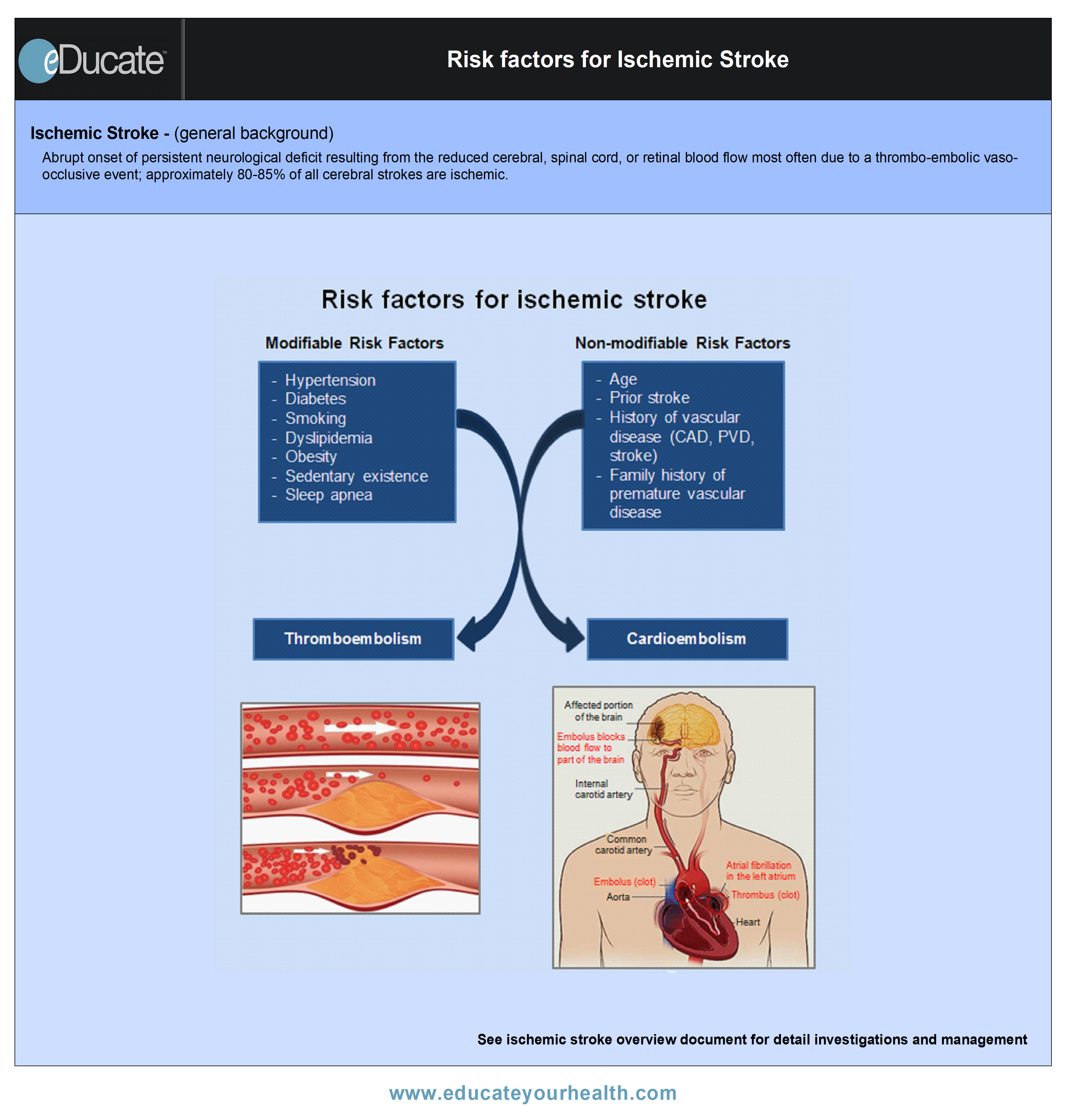 risk-factors-for-ischemic-stroke-qr-educate-health